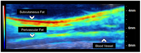 Biomedical imaging system combines optical and ultrasound technology