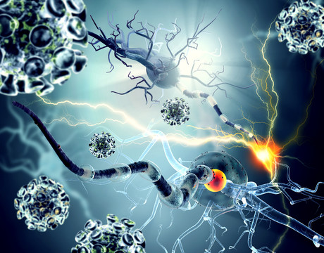 AI predicts Alzheimer's AI predicts Alzheimer's