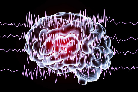 Cannabis compound may benefit children with epilepsy Cannabis compound may benefit children with epilepsy