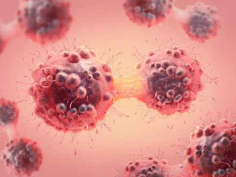 Zapping tumours in less than a second Zapping tumours in less than a second