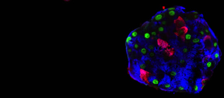 Reprogrammed pancreatic cells relieve diabetes in mice