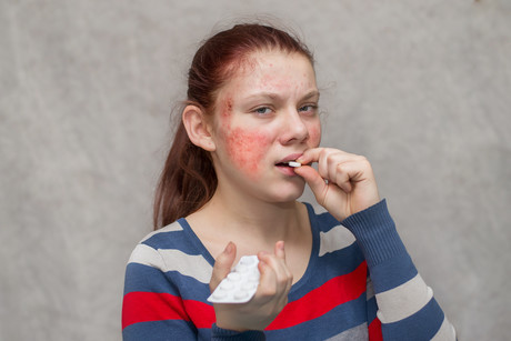 CD-style device to detect antibiotic allergies