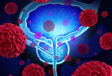 Coffee and testosterone could help slow prostate cancer Coffee and testosterone could help slow prostate cancer