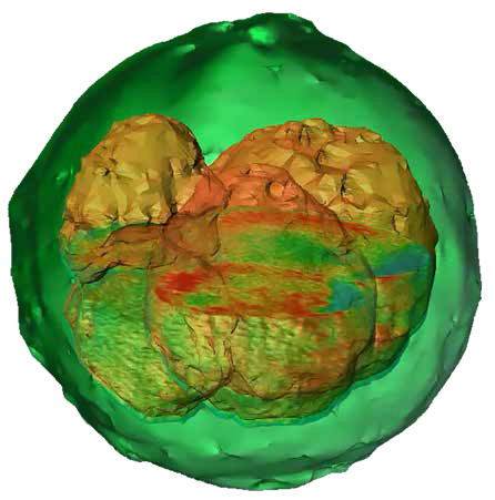 Advancing cell biology with quantitative phase imaging