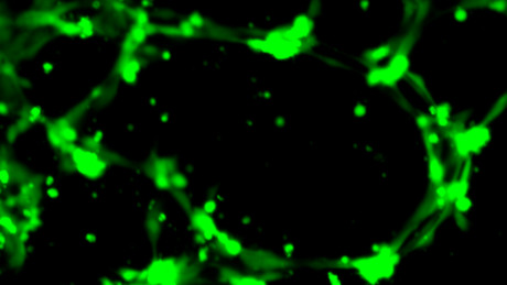 Medieval glass-making technique kills hospital bacteria