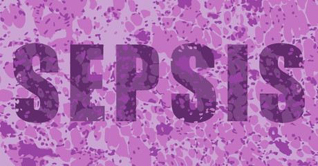 Biomarker may prevent hospital discharge in sepsis patients Biomarker may prevent hospital discharge in sepsis patients