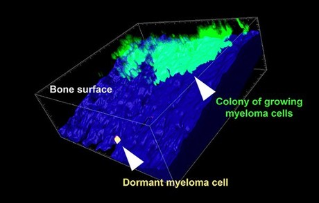 What makes some cancer cells dormant?