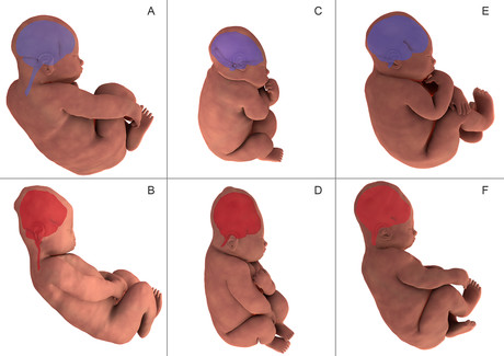 Images show infants&#39; heads changing shape during birth
