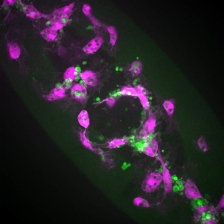 Dead cells disrupt normal immune responses