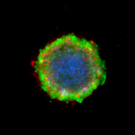 Cell culture platform recreates tumours in 3D