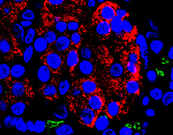 Pancreas-on-a-chip could help cystic fibrosis patients