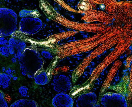 Mini kidneys grown from stem cells