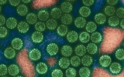 Test predicts cervical cancer risk in HPV-positive women