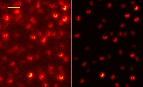 Super-resolution microscopy improved with graphene