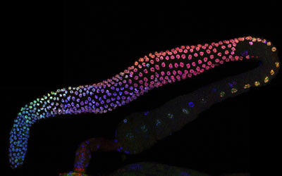 How can roundworms help women extend their fertility?