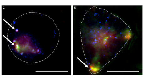 Nanoparticles could transport anticancer agent to cells