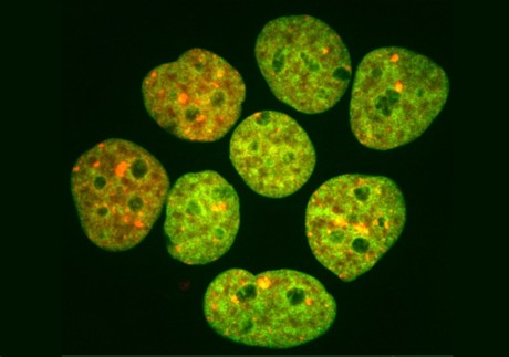 Inside the body's DNA repair shop Inside the body's DNA repair shop