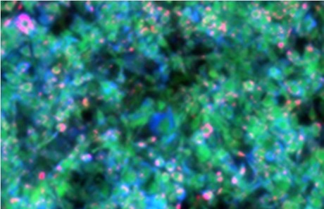 Label-free metabolic imaging method developed