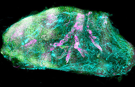 Creating and imaging transparent human organs