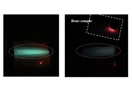 Sensing organ temperature with luminescent powder Sensing organ temperature with luminescent powder