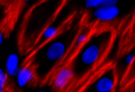 Restarting cell division helps the heart to heal itself