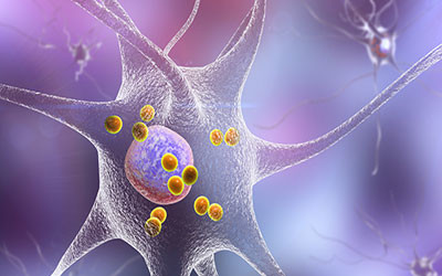 Is Parkinson&#39;s an autoimmune disease?