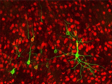 How stress encourages stomach ulcers