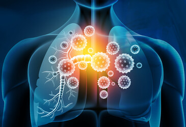Respiratory infection response: a case of mistaken identity Respiratory infection response: a case of mistaken identity