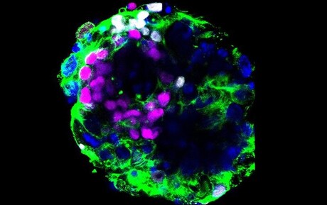 Embryos could be susceptible to COVID-19
