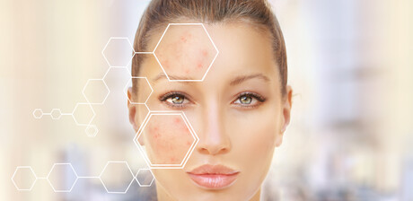 AI algorithm assists in diagnosing skin diseases AI algorithm assists in diagnosing skin diseases