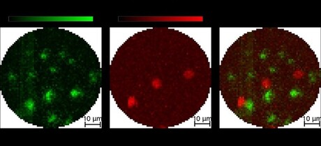 Photoacoustic and fluorescence imaging methods combined Photoacoustic and fluorescence imaging methods combined