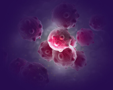 Cancer cells traced back to their tumour of origin