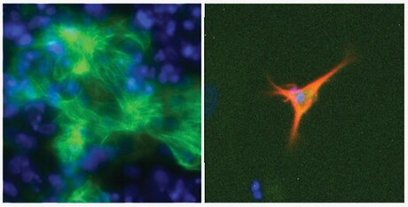 Algorithm helps optimise culture conditions for cell therapy