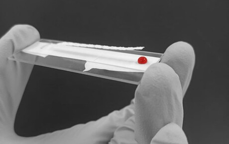 Rapid diagnostic could save people from dying of blood loss Rapid diagnostic could save people from dying of blood loss