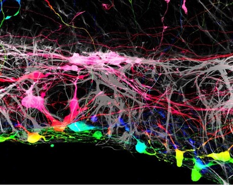 A rift in the retina helps transplanted cells better integrate