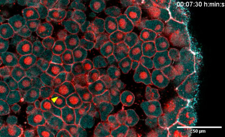 Early signs of immune response found in developing embryos