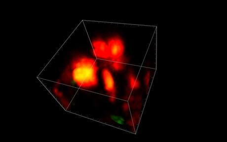 New bone cell could reveal targets for osteoporosis treatment