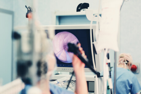 Can artificial intelligence help reduce the rate of bowel cancer? Can artificial intelligence help reduce the rate of bowel cancer?