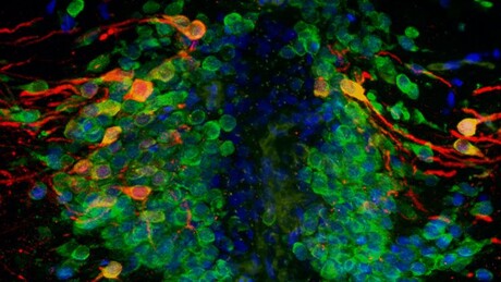 Parkinson&#39;s gene may impair how new neurons are made