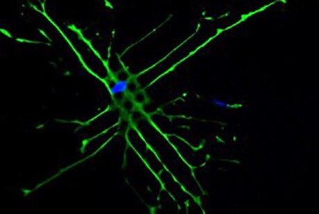 Method tricks stem cells into becoming bone Method tricks stem cells into becoming bone