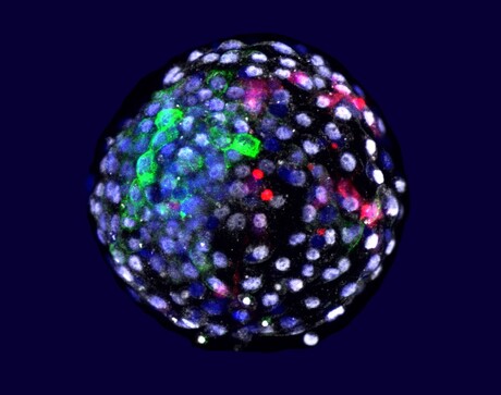 Researchers create human&ndash;monkey chimeric embryos