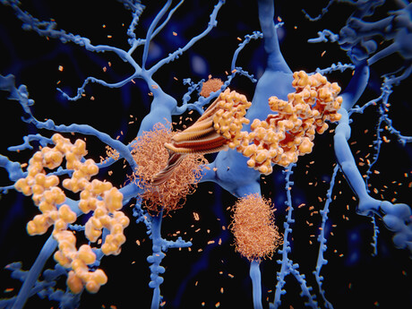 Light-activated molecule clears Alzheimer's protein in mice Light-activated molecule clears Alzheimer's protein in mice