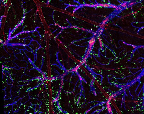 How immune cells communicate across the blood&ndash;brain barrier