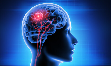 New approach to CAR T cell therapy for brain cancer New approach to CAR T cell therapy for brain cancer