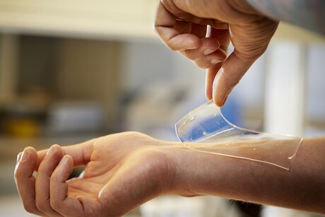 Hydrogel treats wounds, protects against bacteria Hydrogel treats wounds, protects against bacteria