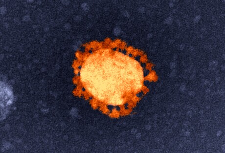 CSIRO announces COVID treatment project, new Chief Scientist