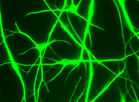 What's the difference between mouse and human brain cells? What's the difference between mouse and human brain cells?