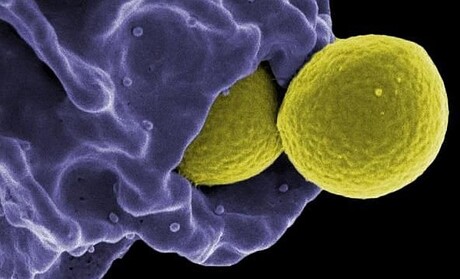 Immune system boosted to fight antibiotic-resistant bacteria Immune system boosted to fight antibiotic-resistant bacteria