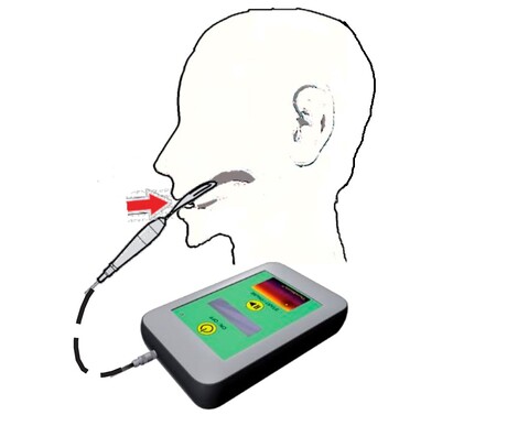 Radio waves improve survival in liver cancer patients