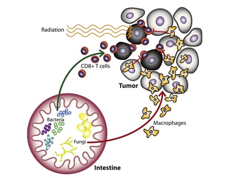 Radiation therapy effectiveness influenced by gut fungi